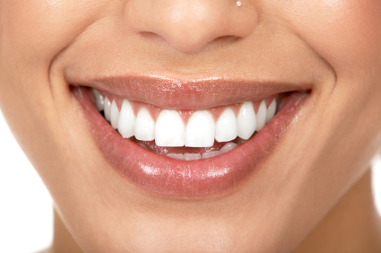 The Past and Present of Dental Veneers – Boca Raton, FL