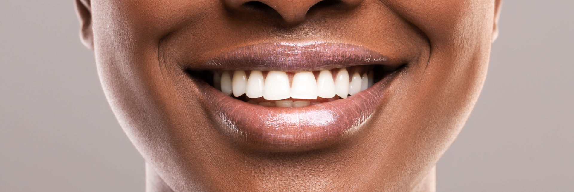 Teeth Whitening in Boca Raton, FL